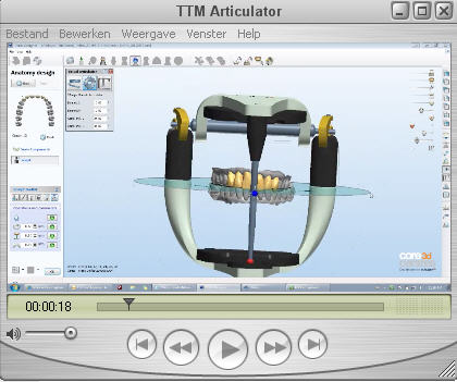 core3d virtuele articulator video